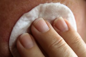 איך ניתן להתמודד עם שינויים בעור הפנים לאחר לידה